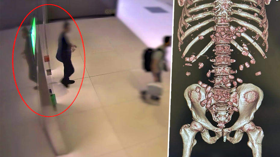 İstanbul Havalimanı'nda Gizli Uyuşturucu Operasyonu: Yürüyüşüyle Şüphe Çekti, Midesinden 26 Kapsül Çıkarıldı