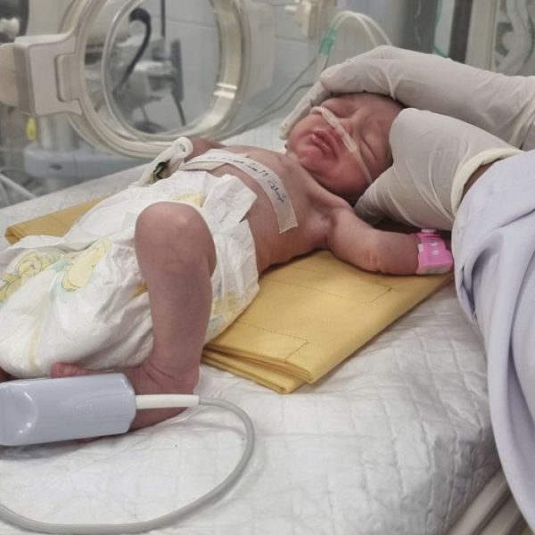 İsrail'in Gazze'ye saldırısında hayatını kaybeden annesinin rahminden kurtarılan bebek hayatını kaybetti.