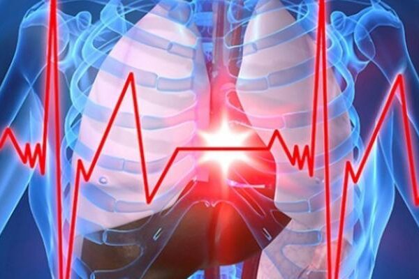 Sırrı Süreyya Önder’in geçirdiği kalp krizi ve aort diseksiyonu nedir? Uzmanlar açıkladı…